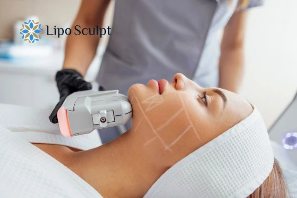 HIFU vs Botulinum Toxin: Understanding the Differences 1 HIFU vs Botox Chippenham What is the best option for you?