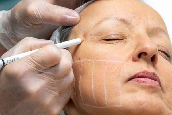 CryoPen: 5 Skin Concerns It May Be Used to Treat 4 What should you ask before having CryoPen treatment Chippenham?
