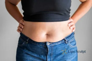 Bidding Farewell to Muffin Tops with Aqualyx Fat Injections 2 Do you wish you could reduce your muffin top Chippenham With Aqualy fat dissolving injections you can!